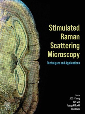 cover image of Stimulated Raman Scattering Microscopy
